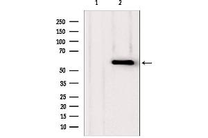 Western blot analysis of extracts from various samples, using PHGDH antibody. (PHGDH Antikörper  (N-Term))