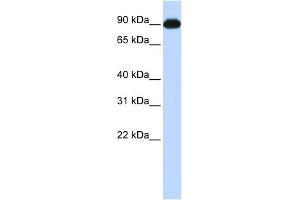 WB Suggested Anti-CTAGE5 Antibody Titration:  0. (MIA2 Antikörper  (Middle Region))
