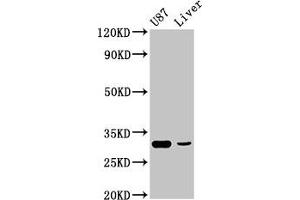 Western Blot Positive WB detected in: U87 whole cell lysate, Rat liver tissue All lanes: ITM2B antibody at 4. (RHCG Antikörper  (AA 416-479))