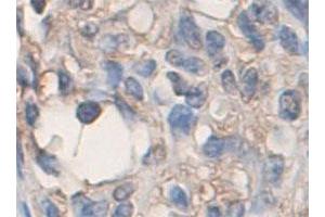 Immunohistochemical staining of formalin-fixed paraffin-embedded human skin tissue with ADAMTS2 polyclonal antibody  at 1 : 200 dilution. (Adamts2 Antikörper  (C-Term))