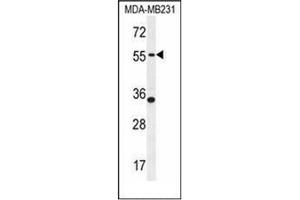 Western blot analysis of PDE12 Antibody (C-term) in MDA-MB231 cell line lysates (35ug/lane). (PDE12 Antikörper  (C-Term))