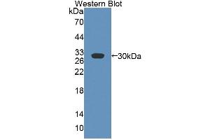 Figure. (ABCB4 Antikörper  (AA 1034-1276))