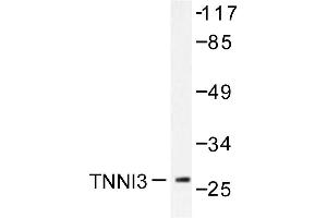 Image no. 1 for anti-Cardiac Troponin I (TNNI3) antibody (ABIN271939) (TNNI3 Antikörper)