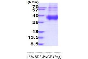 SDS-PAGE (SDS) image for Fc Fragment of IgA, Receptor For (FCAR) (AA 22-227) protein (His tag) (ABIN6388097)