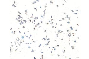 Immunocytochemistry (ICC) image for anti-Syndecan 1 (SDC1) (AA 23-251) antibody (ABIN7795739) (Rekombinanter Syndecan 1 Antikörper  (AA 23-251))