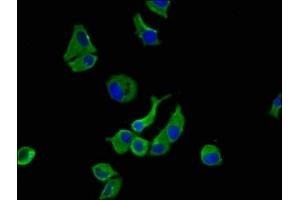 Immunofluorescence staining of MCF-7 cells with ABIN7175658 at 1:100, counter-stained with DAPI. (SORCS1 Antikörper  (AA 34-175))