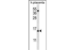 Western blot analysis in human placenta tissue lysates (35ug/lane). (TM4SF18 Antikörper  (AA 113-141))