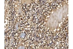 IHC analysis of PMPCA/INPP5 using anti-PMPCA/INPP5 antibody (ABIN7602722). (PMPCA Antikörper  (AA 99-525))