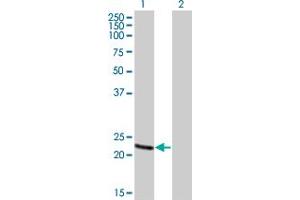 Western Blot analysis of RCV1 expression in transfected 293T cell line by RCV1 monoclonal antibody (M01), clone 4C6. (Recoverin Antikörper  (AA 101-199))