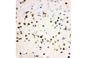 Anti-PLK2 antibody, IHC(P) IHC(P): Rat Brain Tissue (PLK2 Antikörper  (C-Term))