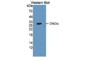 Western Blotting (WB) image for anti-Dipeptidyl-Peptidase 4 (DPP4) (AA 484-728) antibody (ABIN3207613) (DPP4 Antikörper  (AA 484-728))
