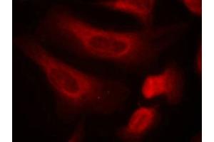 Immunofluorescence staining of methanol-fixed Hela cells using STAT1(Phospho-Ser727) Antibody. (STAT1 Antikörper  (pSer727))
