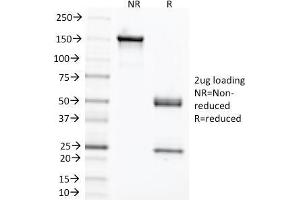SDS-PAGE Analysis Purified CEA Mouse Monoclonal Antibody (C66/1291). (CEACAM5 Antikörper)