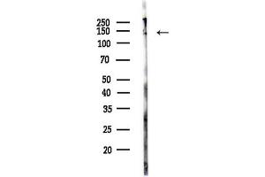 anti-NAC alpha Domain Containing (NACAD) (N-Term) antibody