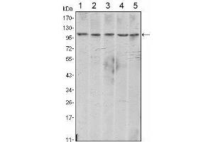 Western Blot showing CDH2 antibody used against A431 (1), NIH/3T3 (2), Hela (3), C6 (4) and LNCap (5) cell lysate. (N-Cadherin Antikörper)