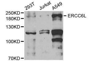 Western blot analysis of extracts of various cell lines, using ERCC6L antibody (ABIN5973617) at 1/1000 dilution. (ERCC6L Antikörper)