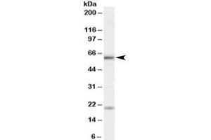Western blot testing of HeLa cell lysate with BMPR1A antibody at 1ug/ml. (BMPR1A Antikörper)