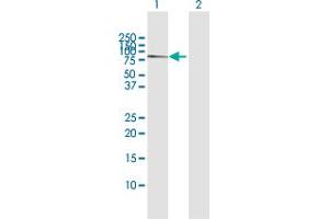 Western Blot analysis of CACNB1 expression in transfected 293T cell line by CACNB1 MaxPab polyclonal antibody. (CACNB1 Antikörper  (AA 1-598))