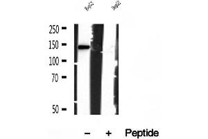 Western blot analysis of extracts of HepG2 cells, using IFT140 antibody. (IFT140 Antikörper  (Internal Region))
