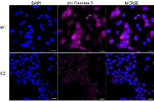 Immunocytochemical staining of HeLa cells using pro Caspase 3 antibody (ABIN7799900), 1:1,000), Top panel: wild-type (WT), Bottom panal: pro Caspase 3 shRNA knockdown (KD). (Rekombinanter Pro Caspase 3 Antikörper)