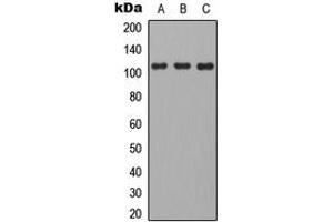 Western blot analysis of CD101 expression in HEK293T (A), mouse brain (B), H9C2 (C) whole cell lysates. (CD101 Antikörper  (Center))