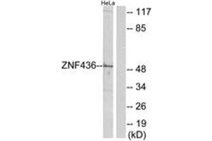 Western Blotting (WB) image for anti-Zinc Finger Protein 436 (ZNF436) (AA 71-120) antibody (ABIN2889749) (ZNF436 Antikörper  (AA 71-120))
