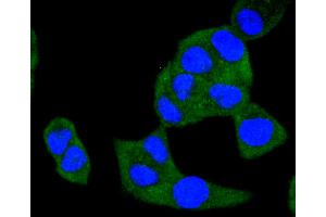 HeLa cells were stained with A-RAF (24D1) Monoclonal Antibody  at [1:200] incubated overnight at 4C, followed by secondary antibody incubation, DAPI staining of the nuclei and detection.