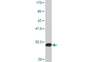 Western Blot detection against Immunogen (31. (P2RY1 Antikörper  (AA 1-52))