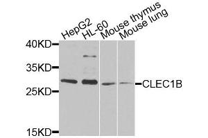 Western blot analysis of extracts of various cell lines, using CLEC1B antibody (ABIN6003679) at 1/1000 dilution. (C-Type Lectin Domain Family 1, Member B (CLEC1B) Antikörper)