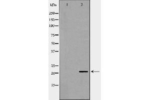 Western blot analysis of Hela whole cell lysates, using DHFR Antibody. (Dihydrofolate Reductase Antikörper)