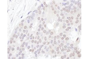 Immunohistochemistry (IHC) image for anti-YLP Motif Containing 1 (YLPM1) (AA 1350-1400) antibody (ABIN7455004) (YLPM1 Antikörper  (AA 1350-1400))