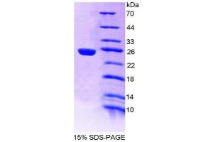 SDS-PAGE (SDS) image for Proteasome (Prosome, Macropain) Subunit, beta Type, 9 (Large Multifunctional Peptidase 2) (PSMB9) (AA 22-219) protein (His tag) (ABIN1980717)