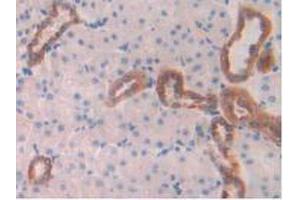 IHC-P analysis of Rat Kidney Tissue, with DAB staining. (Cathepsin D Antikörper  (AA 120-407))