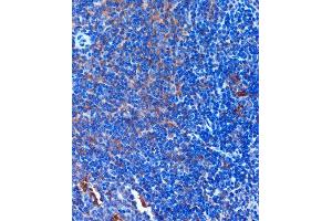 Immunohistochemistry (IHC) image for anti-T-Cell, Immune Regulator 1, ATPase, H+ Transporting, Lysosomal V0 Subunit A3 (TCIRG1) (AA 1-130) antibody (ABIN7270707)