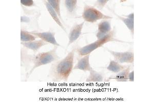 Image no. 2 for anti-F-Box Protein 11 (FBXO11) (Internal Region) antibody (ABIN559708)