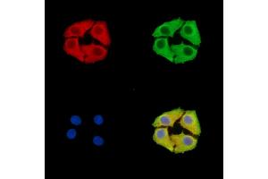 ABIN7096146 and ABIN7100208 staining Hela cells by IF/ICC.