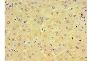 Immunohistochemistry of paraffin-embedded human liver tissue using ABIN7148439 at dilution of 1:100 (CRX Antikörper  (AA 120-285))