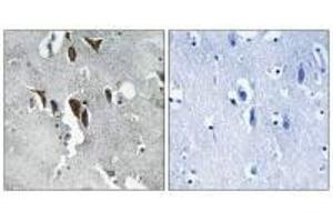 Immunohistochemistry analysis of paraffin-embedded human brain tissue using ELOVL5 antibody. (ELOVL5 Antikörper)