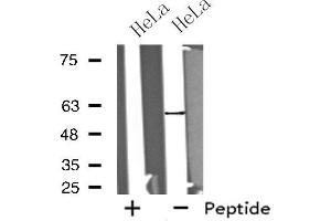 Western blot analysis of extracts from HeLa cells, using GPROPDR antibody. (GPROPDR Antikörper)