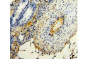 Used in DAB staining on fromalin fixed paraffin-embedded Lung tissue (JAM2 Antikörper  (AA 74-250))