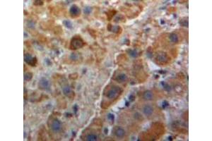 IHC-P analysis of Liver tissue, with DAB staining. (PLG Antikörper  (AA 582-812))