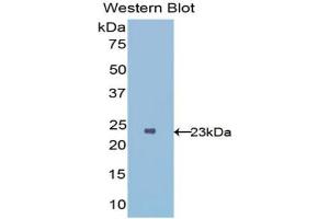 Western blot analysis of the recombinant protein. (IL1RL1 Antikörper  (AA 162-349))