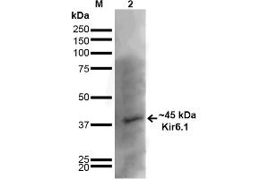 Western Blot analysis of Rat Brain showing detection of ~45 kDa Kir6. (KCNJ8 Antikörper  (AA 306-424) (Biotin))