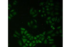 Figure. (QSOX1 Antikörper  (AA 394-519))