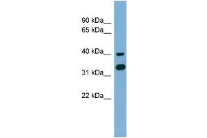 WB Suggested Anti-GPN2 Antibody Titration: 0. (GPN2 Antikörper  (Middle Region))