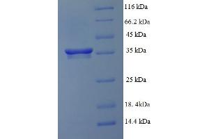 SDS-PAGE (SDS) image for GC-Rich Promoter Binding Protein 1 (GPBP1) (AA 293-473), (partial) protein (His-SUMO Tag) (ABIN5711489)