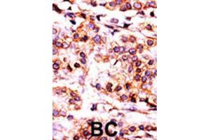 Immunohistochemistry (IHC) image for anti-Pantothenate Kinase 1 (PANK1) antibody (ABIN3003019) (PANK1 Antikörper)