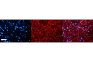 Rabbit Anti-KCNN3 Antibody    Formalin Fixed Paraffin Embedded Tissue: Human Adult heart  Observed Staining: Membrane Primary Antibody Concentration: 1:600 Secondary Antibody: Donkey anti-Rabbit-Cy2/3 Secondary Antibody Concentration: 1:200 Magnification: 20X Exposure Time: 0.
