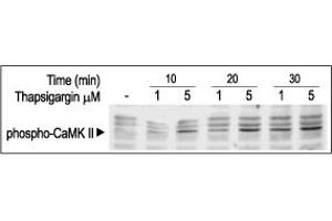 Cells were starved for 2h and then stimulated with 1 or 5 μM Thapsigargin (ABIN7886005) for the indicated times. (Thapsigargin)