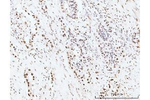 IHC analysis of KIFC1 using anti-KIFC1 antibody (ABIN7599523). (KIFC1 Antikörper  (AA 1-673))
